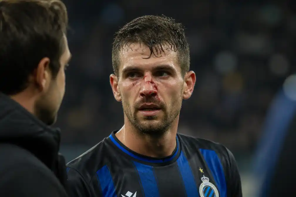 Mechele breekt neus na elleboogstoot tegen Inter en speelt match uit