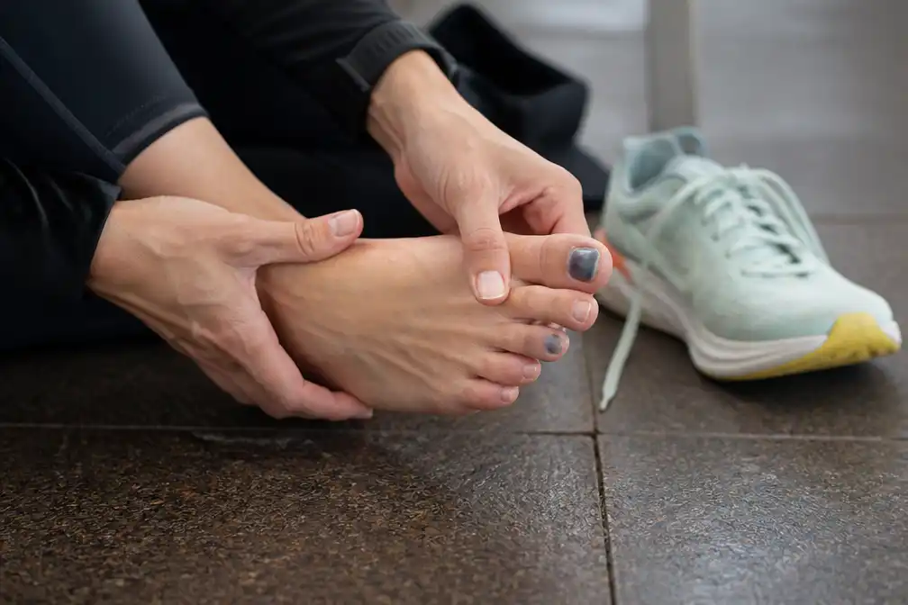Blauwe teennagels na het hardlopen: sportarts legt 'runners toe' uit